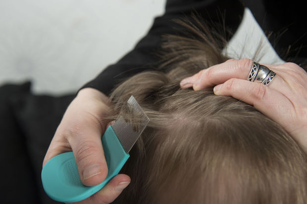 how to check for lice