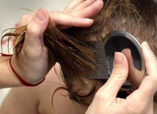 How to Prevent Lice? how to prevent lice