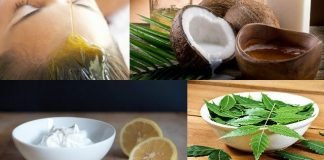 Home Remedies for Dandruff Home remedies for dandruff