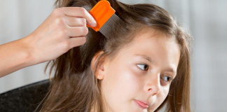 Home Remedies for Lice Home remedies for lice