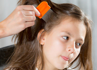Home Remedies for Lice Home remedies for lice