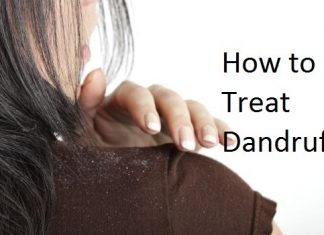 How to Treat Dandruff? Treat dandruff