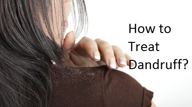 how to treat dandruff