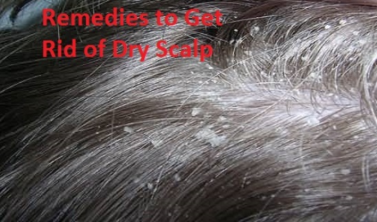 remedies to get rid of dry scalp